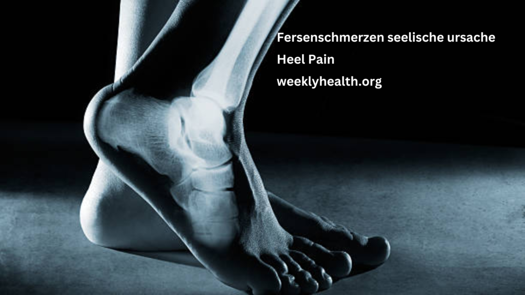 heel pain